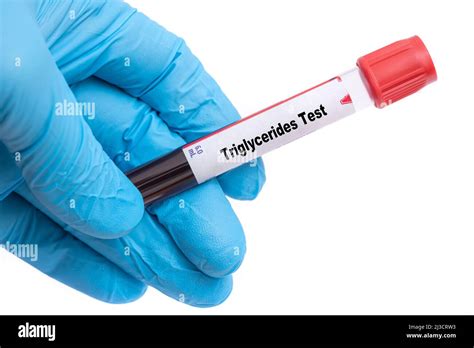 what blood test checks triglycerides